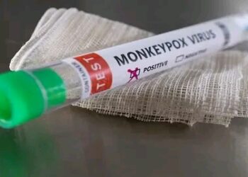 First case of monkeypox detected in Gauteng